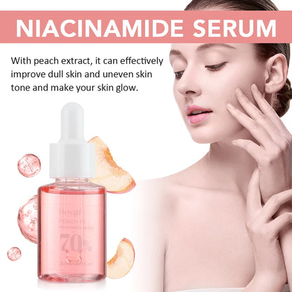 30ml Niacinamide Serum – Dark Spot Corrector, Melanin Removal & Pore-Shrinking Hydrating Skin Care