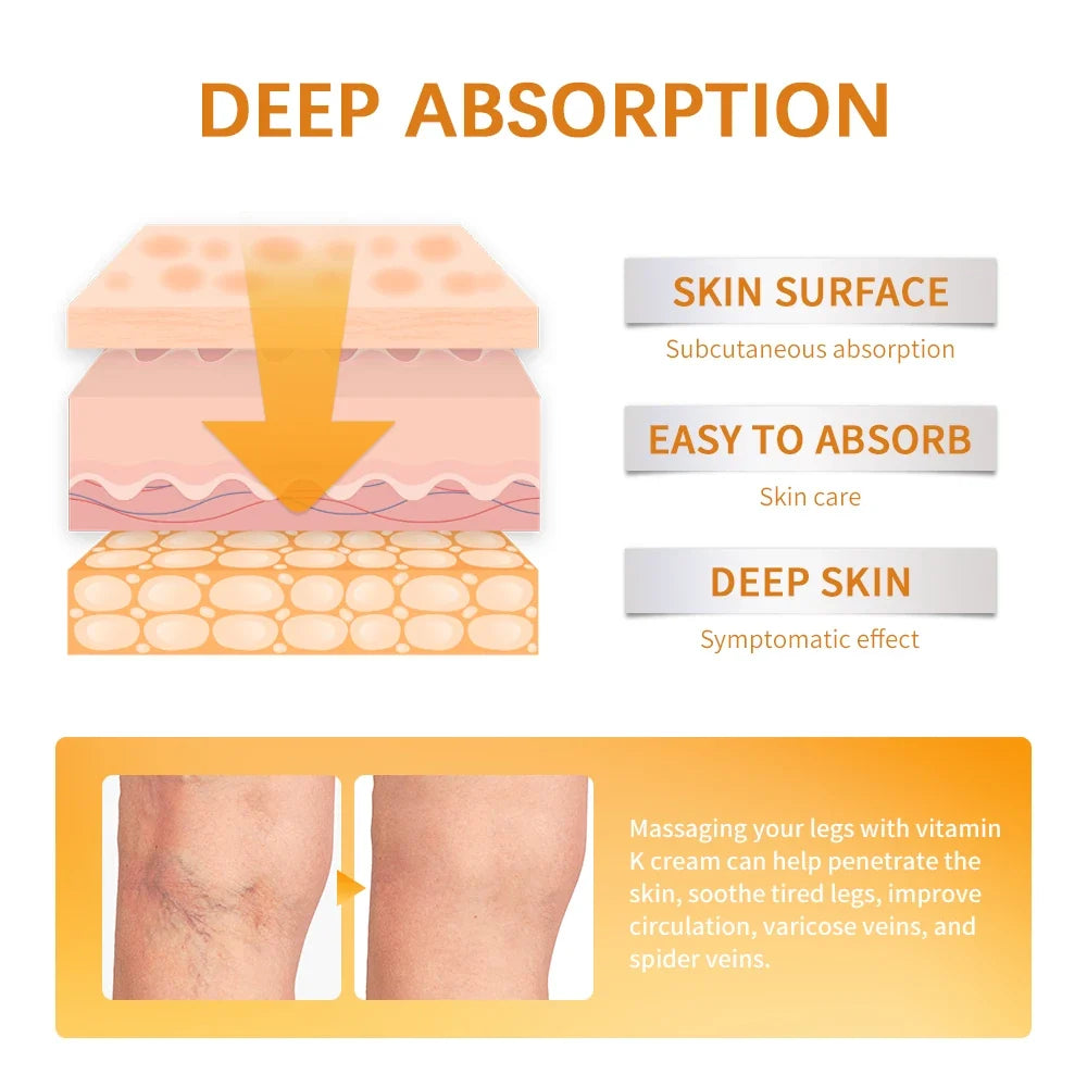 Vitamin K Leg Care Cream - Soothing Massage Cream for Tired Legs, Varicose Vein & Spider Vein Appearance Support