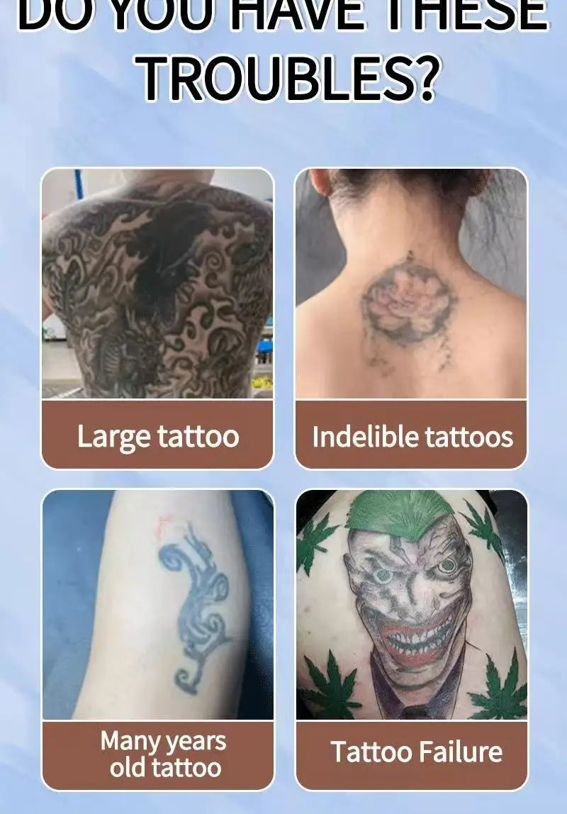 Tattoo Removal Spray — Fast-Acting Formula Removes Tattoos in 7 Days