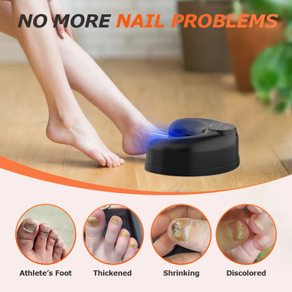 Wireless Multi-Toenail Laser Fungus Treatment Device – 45W Blue & Infrared Light Nail Care System