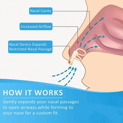 Silicone Nose Dilator Clip – Anti-Snoring Device for Easy Breathing & Improved Sleep