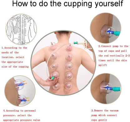 12/24-Cup Chinese Vacuum Cupping Therapy Set – Pull-Out Suction Massager for Pain Relief & Muscle Relaxation