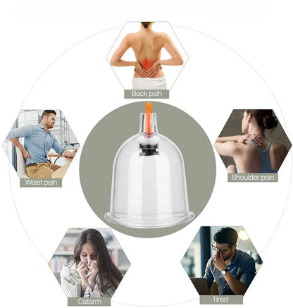 12/24-Cup Chinese Vacuum Cupping Therapy Set – Pull-Out Suction Massager for Pain Relief & Muscle Relaxation