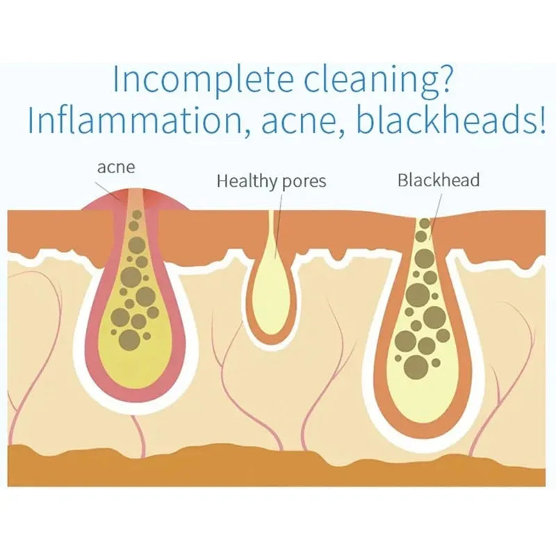 New Peeling Beauty Device – Small Bubble Oxygen Injection Hydra Dermabrasion Aqua Facial Cleaner for Blackhead Removal