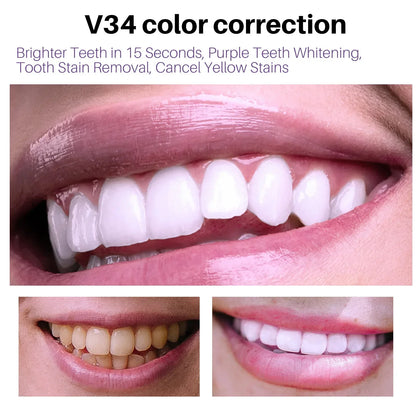 Teeth Whitening Toothpaste – Fruit Acid Formula for Plaque Removal, Stain & Calculus Cleanser, Fresh Breath & Oral Hygiene
