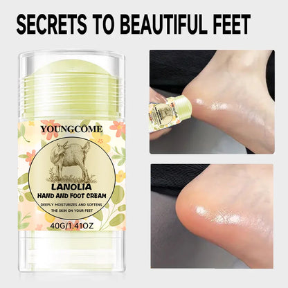 YOUNGCOME Hand & Foot Cream – Deep Moisturizing Repair for Dry, Cracked Skin | Hydrating Softening Lotion