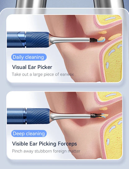Visual Ear Cleaner with Camera – 12MP Ear Wax Removal Tool with Ear Pick, Tweezers & 6 Ear Spoons for Ear Care