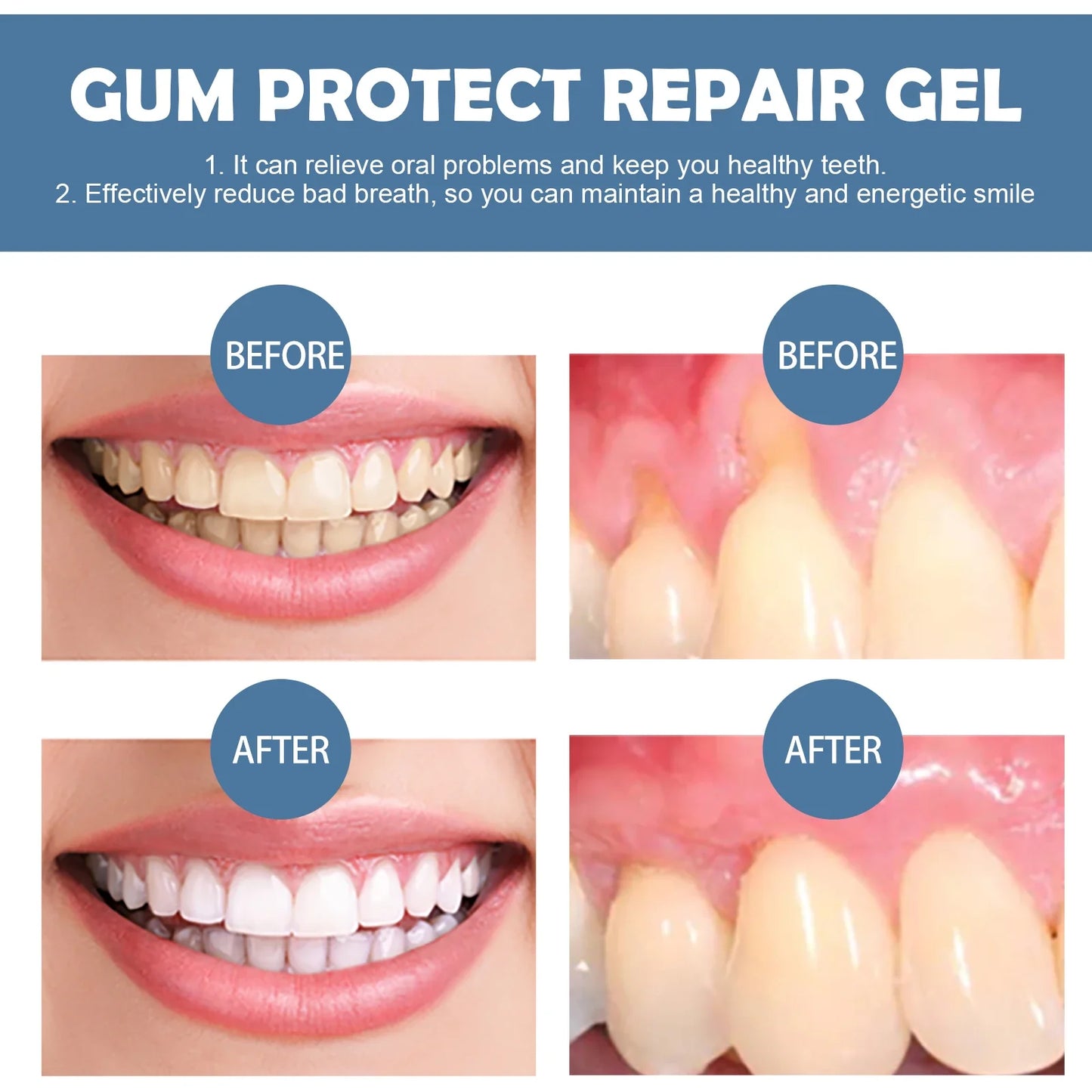 Dental Repair Gel – Deep-Cleaning Tooth & Gum Care, Soothes Inflamed Gums & Reduces Bad Breath