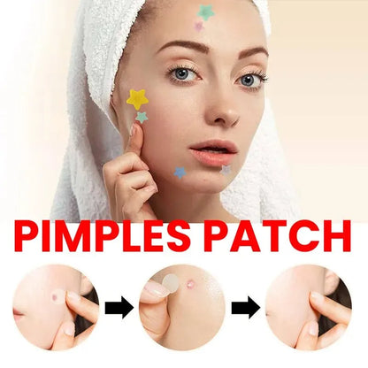 Acne Patch for Facial Skin Care - Fade Blemishes & Pimple Marks - Cover & Repair Acne Blemishes