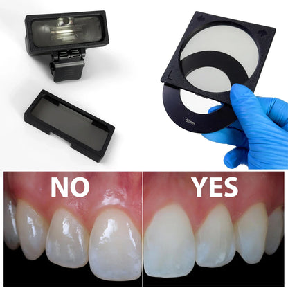 Godox MF12 Dental Photography Polarizer Kit Cross-Polarization Flash Set for Reflection-Free Intraoral & Clinical Imaging