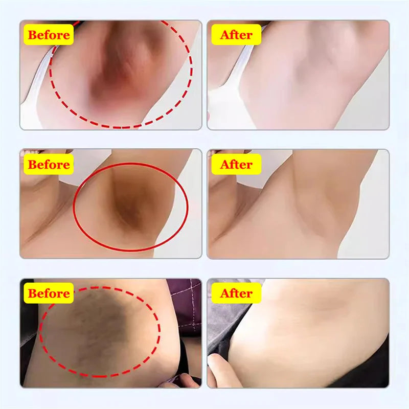 Whitening Cream for Private Parts – Underarm, Inner Thigh & Knee Brightening Serum
