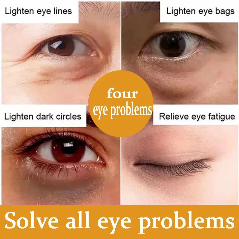 Anti-Dark Circle Eye Serum — Retinol Oil for Wrinkle Removal, Firming, Eye Bag Reduction, Fine Line Fading & Brightening Korean Eye Care