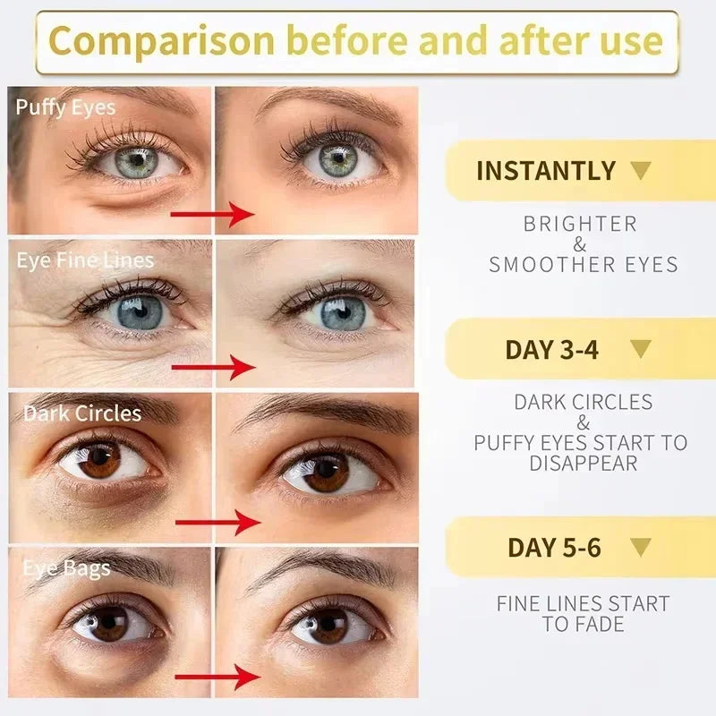Instant Eye Bag Removal Cream – Collagen, Anti-Wrinkle, Dark Circle & Puffiness Treatment for Firming and Brightening