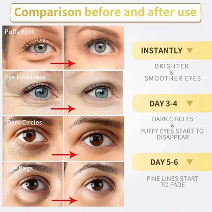 Instant Eye Bag Removal Cream – Collagen, Anti-Wrinkle, Dark Circle & Puffiness Treatment for Firming and Brightening