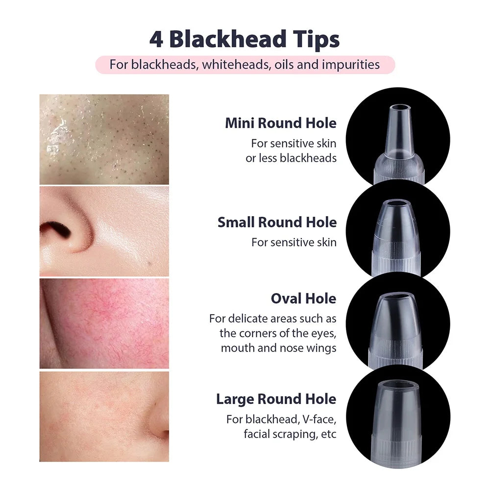 Professional Diamond Microdermabrasion Machine – At-Home Facial Peeling & Deep Cleaning Skin Care Tool