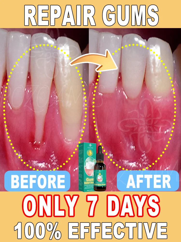 2025 Advanced Gum Care Device — Powerful Technology to Eliminate Gum Recession, Bleeding, and Tooth Pain