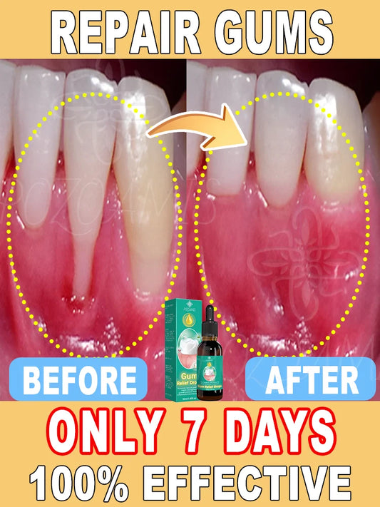 2025 Advanced Gum Care Device — Powerful Technology to Eliminate Gum Recession, Bleeding, and Tooth Pain