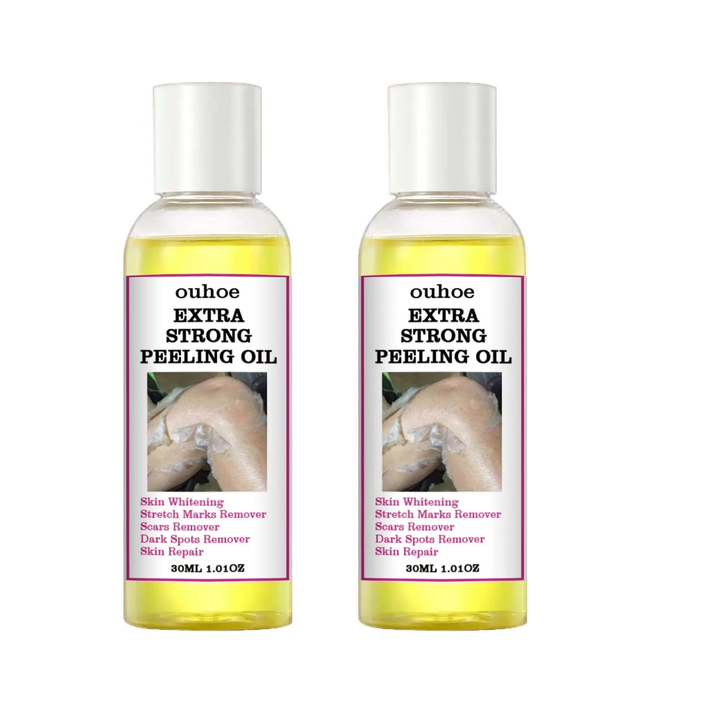 30/110ml Super Strength Yellow Peeling Oil – Brightening & Exfoliating Body Oil for Even Skin Tone & Moisturizing Care