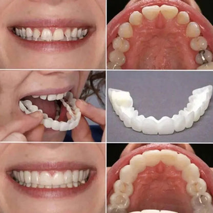 Teeth Veneers & Whitening Denture Kit – Temporary False Teeth Cover for Comfortable, Perfect Smile