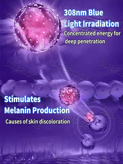 2025 Upgraded Blue Light Pen – Vitiligo Treatment Tool