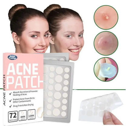 72pcs Invisible Anti-Acne Pimple Patches – Hydrocolloid Waterproof Spot & Mark Repair Stickers