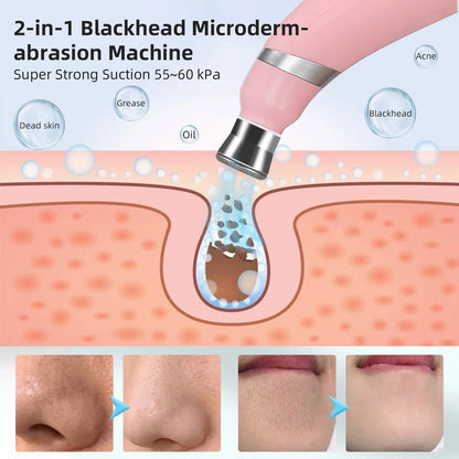 Foreverlily Portable Diamond Peeling Machine – Microdermabrasion Facial Cleaner & Blackhead Remover Vacuum Device