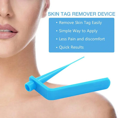 Skin Care Rubber Bands & Skin Tag Remover Kit — Mole & Wart Removal Tool for Face Care, Green Beauty & Health