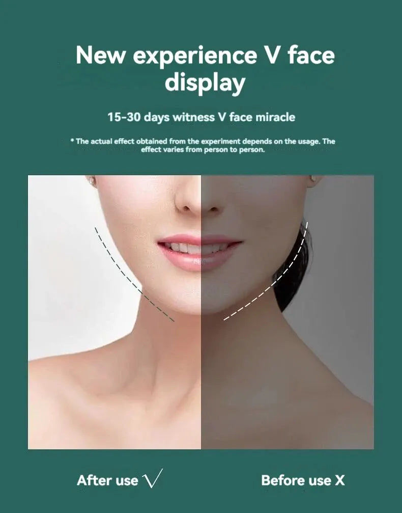 Slimming Face Belt – Lifting Double Chin Mask for All Face Shapes, Tight but Comfortable Facial Slimming Tool