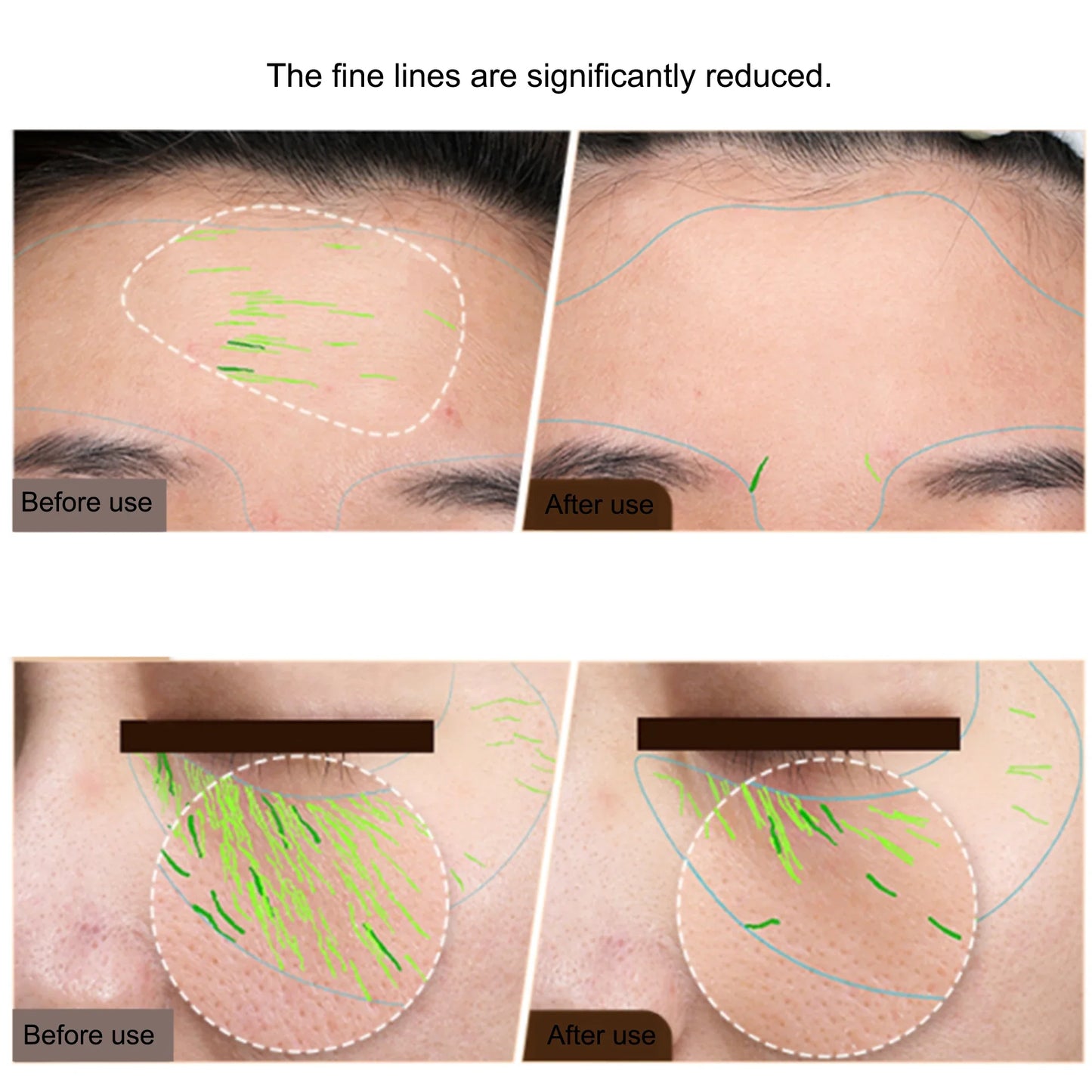 EMS Facial & Body RF Machine – Professional Radio Frequency Beauty Device for Skin Tightening, Face Lifting, and Anti-Aging