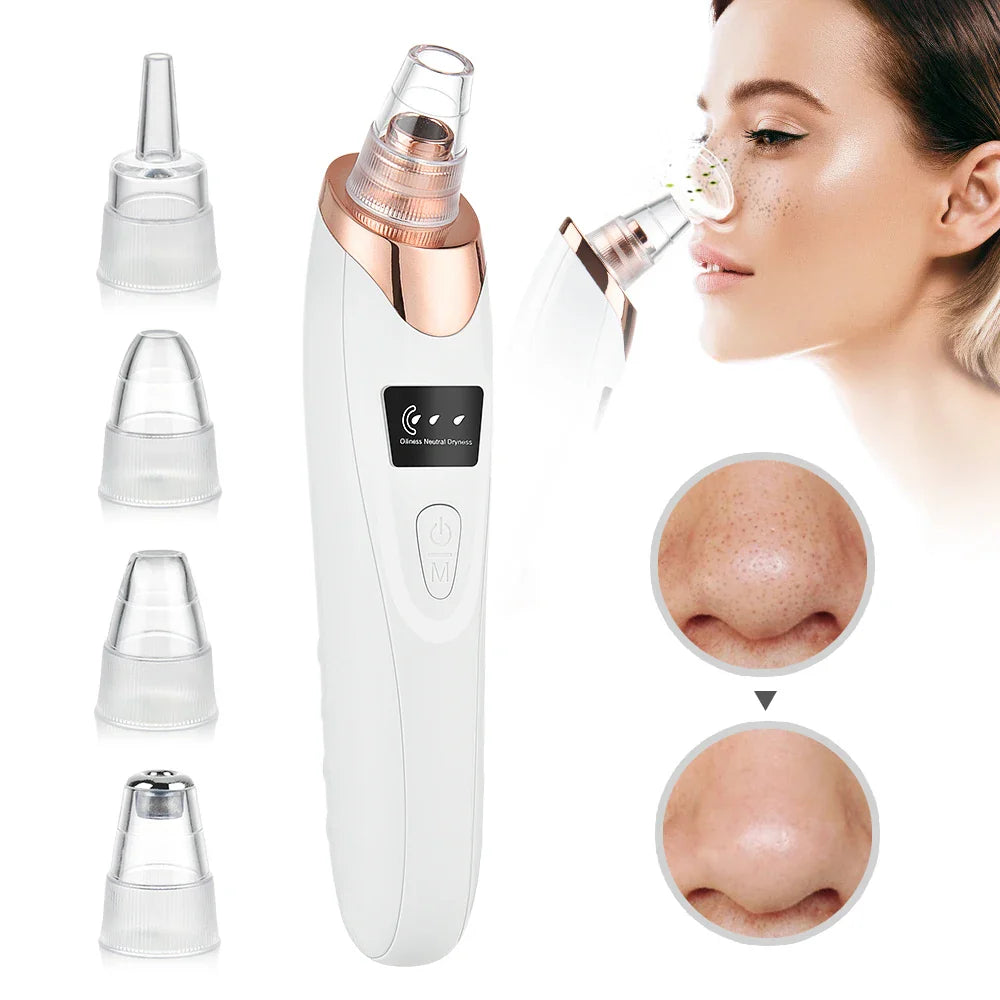 3-Mode Blackhead Remover Vacuum – Facial Pore Cleaner & Dead Skin Removal Beauty Tool
