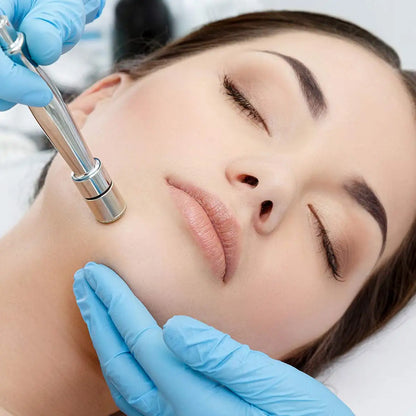 Diamond Microdermabrasion Machine – 65-68cmHg Suction Professional Facial Skin Care Equipment for Home Use