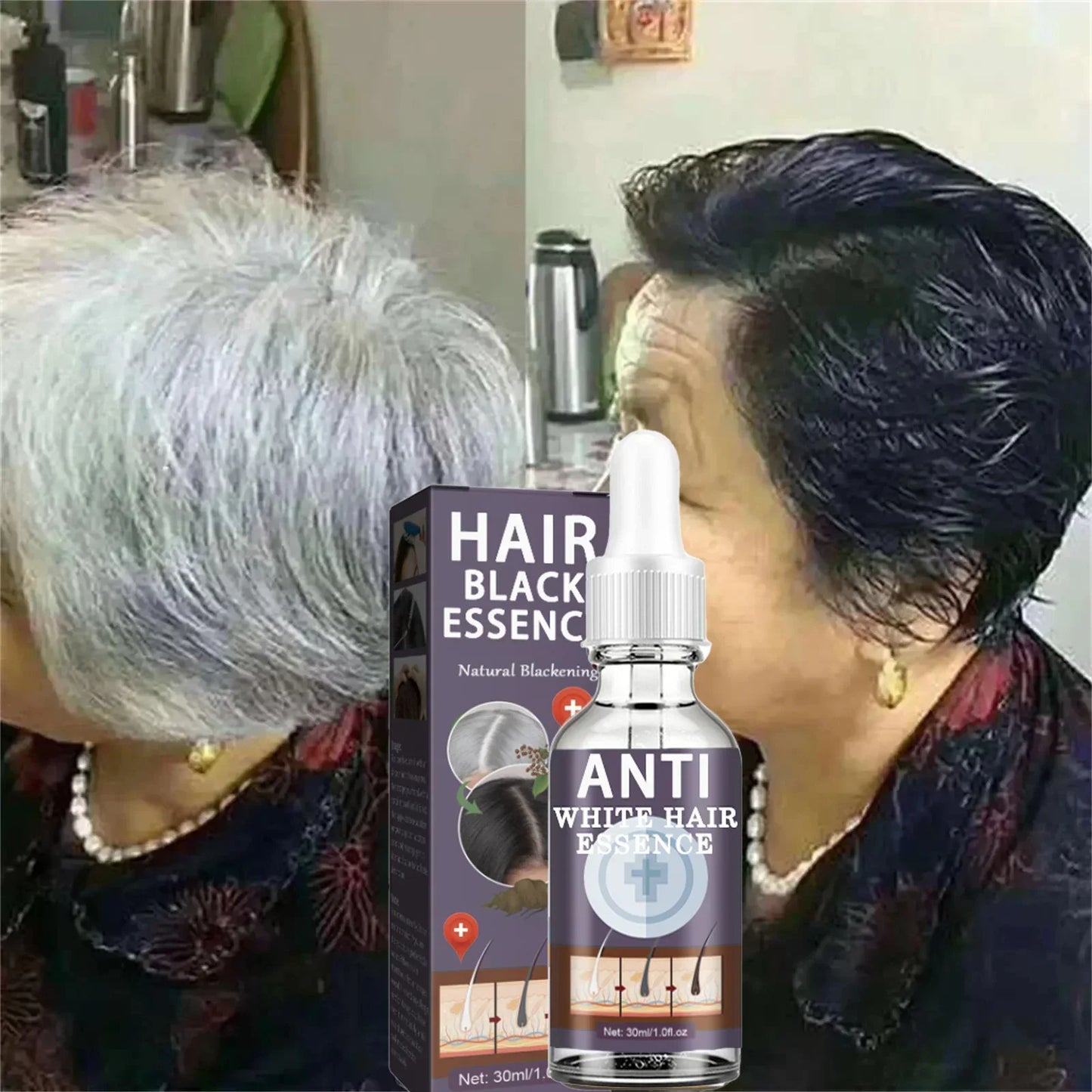 White Hair Remover – Restore Natural Hair Color in 7 Days, Gray Hair Treatment Solution