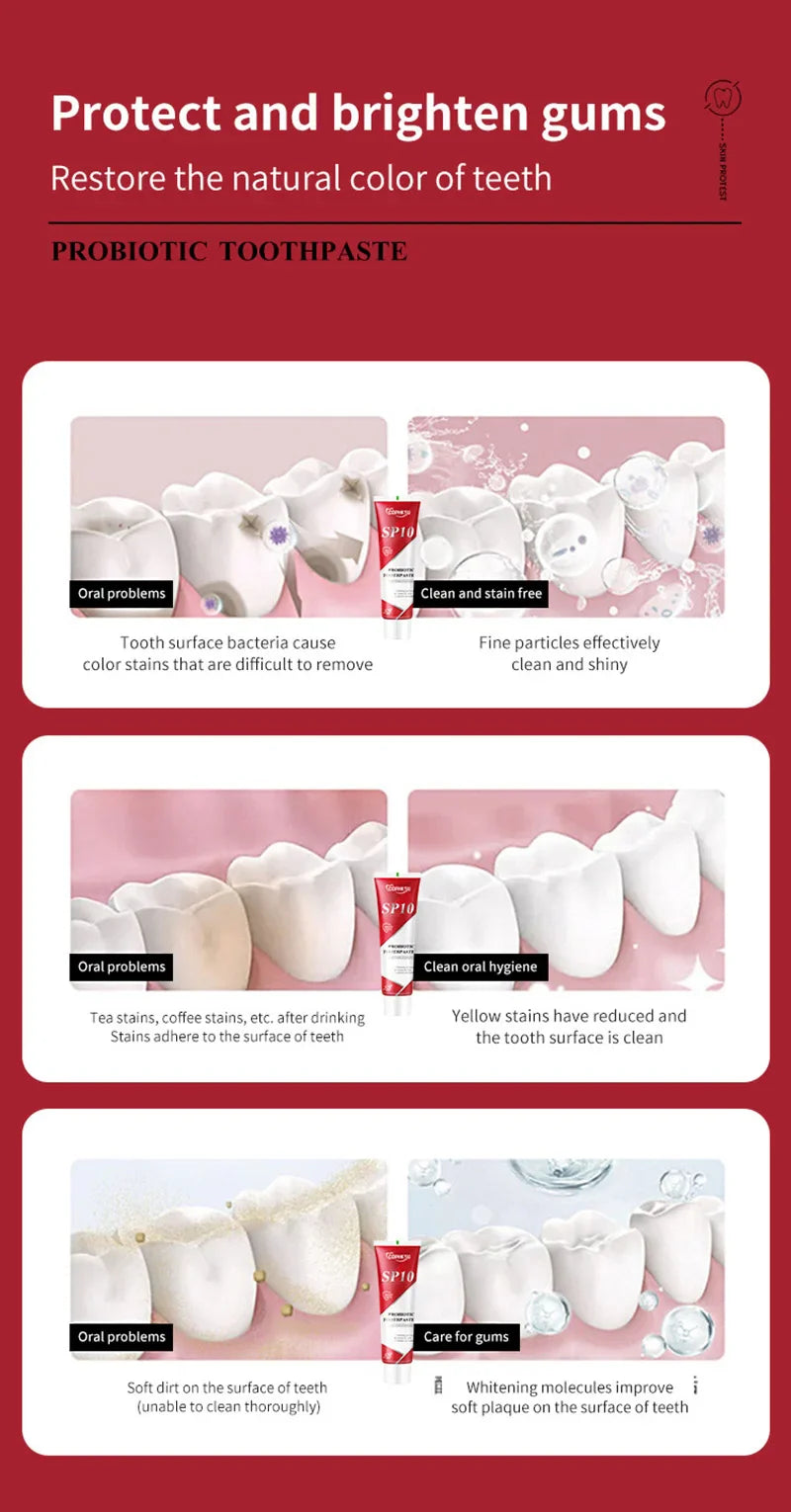 SP-10 Fresh Breath & Whitening Toothpaste – Removes Plaque, Yellow Stains & Supports Gum Health for Oral Care