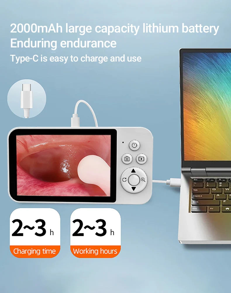 DDCAMERA 4.3" Digital Otoscope – 1080P Ear Scope with 6 LED Lights for Ear Wax Removal, Photo & Video Support