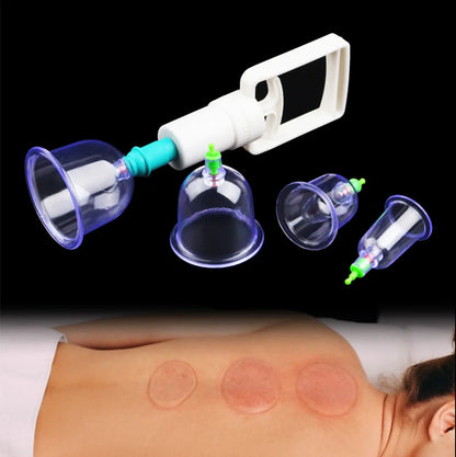 6PCS Vacuum Cupping Set with Pumping Gun – Suction Cups for Back Massage, Body Detox & Anti-Cellulite Therapy