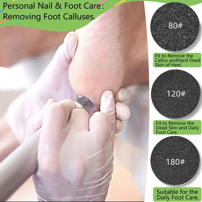 100-Piece Pedicure Sanding Paper Set — Replaceable Foot Callus Removal Discs with 1 Pedicure Disk Pad