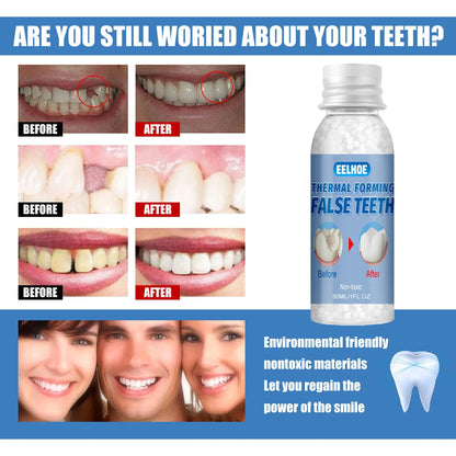 Resin False Teeth & Solid Gums — Temporary Filling Material for Dentistry, Oral Care, Denture Restoration 20/30ml