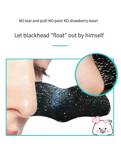 5PCS Blackhead Removal Nasal Strips – Acne & Pore Shrinking, Deep Cleaning Magic Adsorption for Smooth Skin