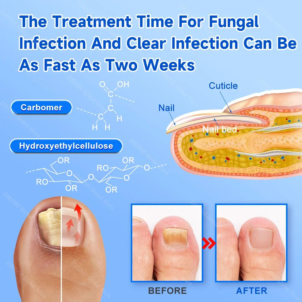 2-in-1 Fungal Nail Laser Device – Fast Repair for Toenail & Fingernail Fungus, Onychomycosis Treatment & Foot Care