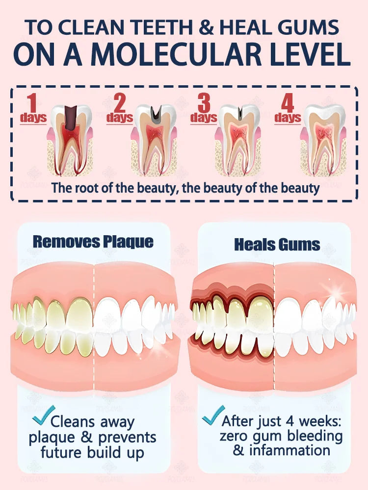Rapid Cavity Repair Toothpaste – Effective Tooth Decay Treatment