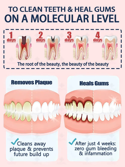Rapid Cavity Repair Toothpaste – Effective Tooth Decay Treatment
