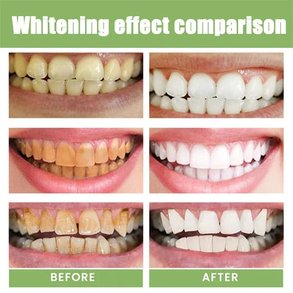 5 Day Teeth Whitening Powder – Removes Plaque & Stains, Deep Cleaning, Fresh Breath & Oral Hygiene Care