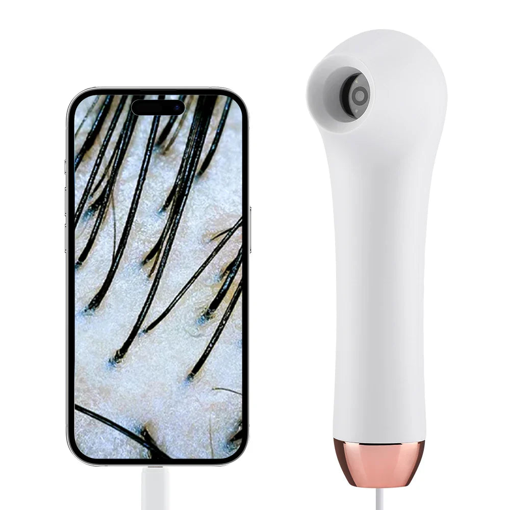 Wireless Dermatoscope Skin Analyzer — 1000X WiFi Magnifier for Scalp & Facial Skin Diagnostics