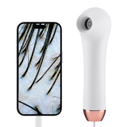 Wireless Dermatoscope Skin Analyzer — 1000X WiFi Magnifier for Scalp & Facial Skin Diagnostics
