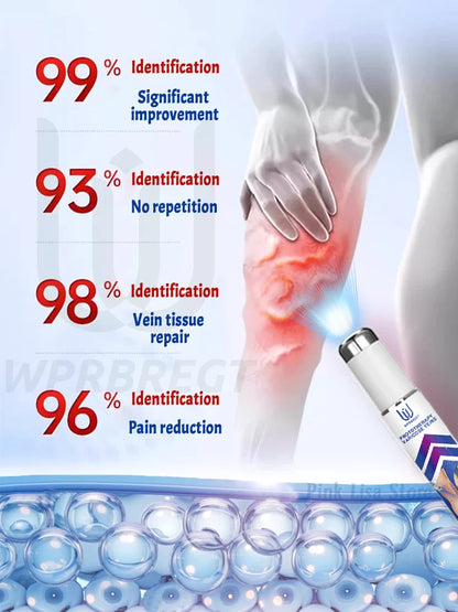 2nd Gen Varicose Vein Laser Therapy Device – Relieves Spider Leg Pain, Treats Vasculitis & Phlebitis