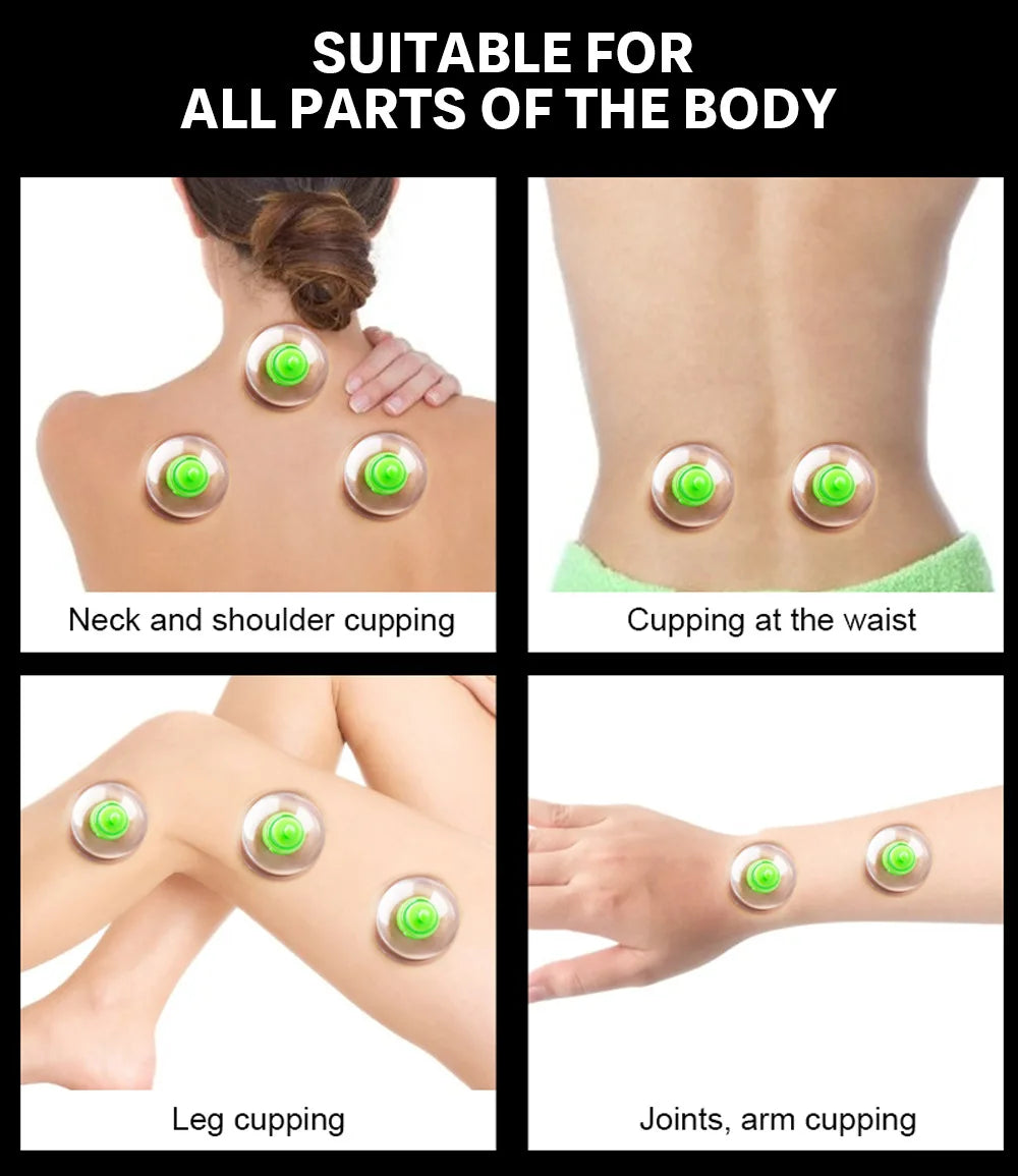 6PCS Vacuum Cupping Set with Pumping Gun – Suction Cups for Back Massage, Body Detox & Anti-Cellulite Therapy