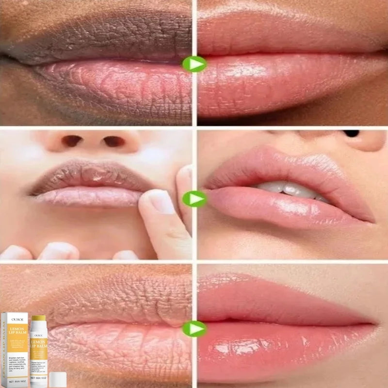 Lip Lightening Balm – Melanin Removing Gloss for Exfoliating and Moisturizing