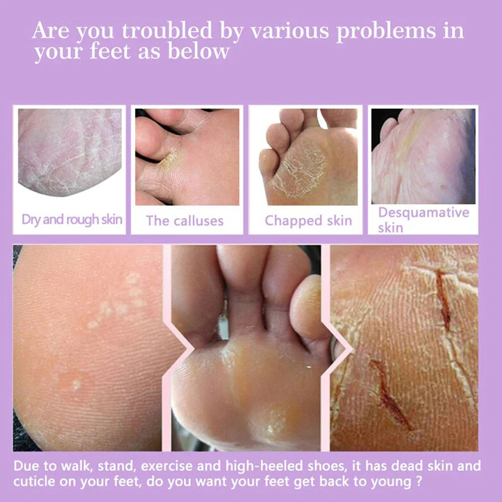 FlowWeek Exfoliating Foot Mask – Removes Dead Skin, Calluses & Dry, Chapped Feet for Smooth, Soft Skin