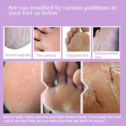 FlowWeek Exfoliating Foot Mask – Removes Dead Skin, Calluses & Dry, Chapped Feet for Smooth, Soft Skin