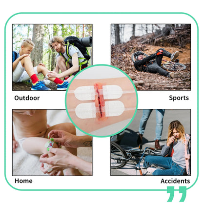 RHINO RESCUE Zip Stitch Laceration Closure Kit — Wound Closure Strips with Dressings, Suture-Free Care